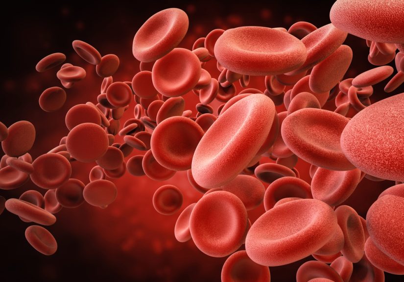5 Myths of Treating Sickle Cell Disease With Automated Red Blood Cell Exchange
