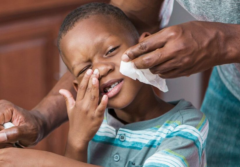 Allergic Salute: Nasal Creases, Prevention, and More