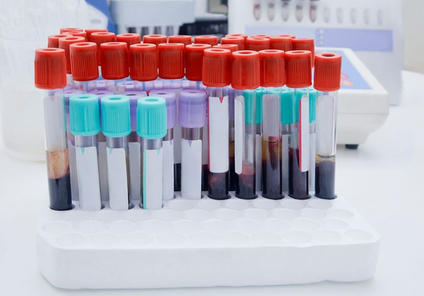 Hemophilia Labs: Clotting Factor Tests, APTT, PT, and More