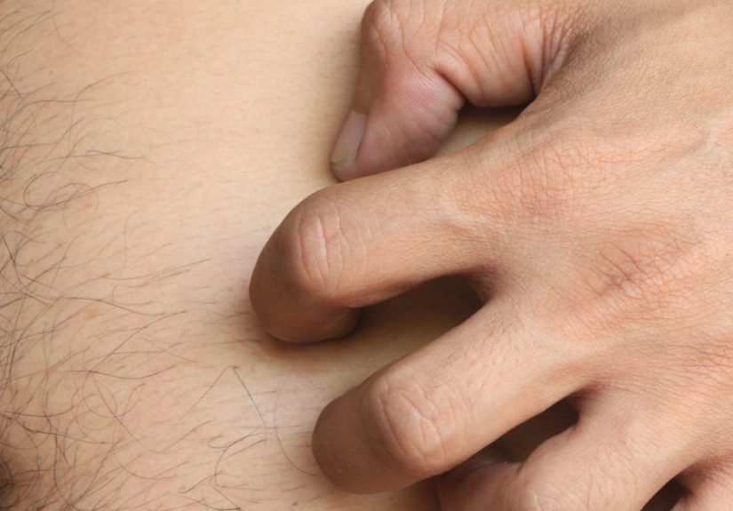 Itchy stomach: Causes, symptoms, and treatment