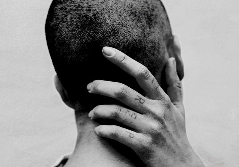 Post-traumatic arthritis: What it is, symptoms, and more