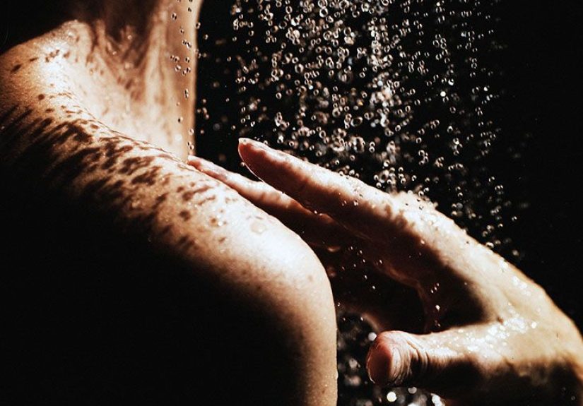 What is the Recovery Time for a Shoulder Impingement?