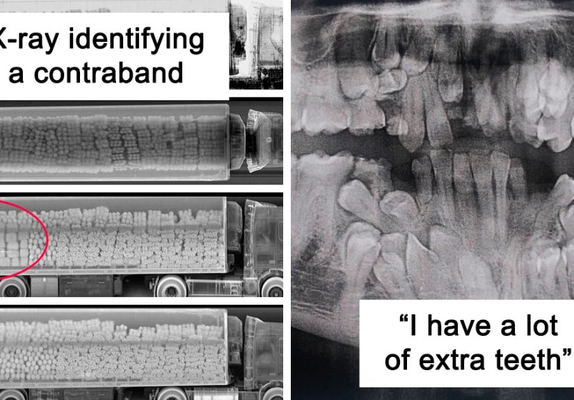 50 Times People X-Rayed Things And Got Interesting Results