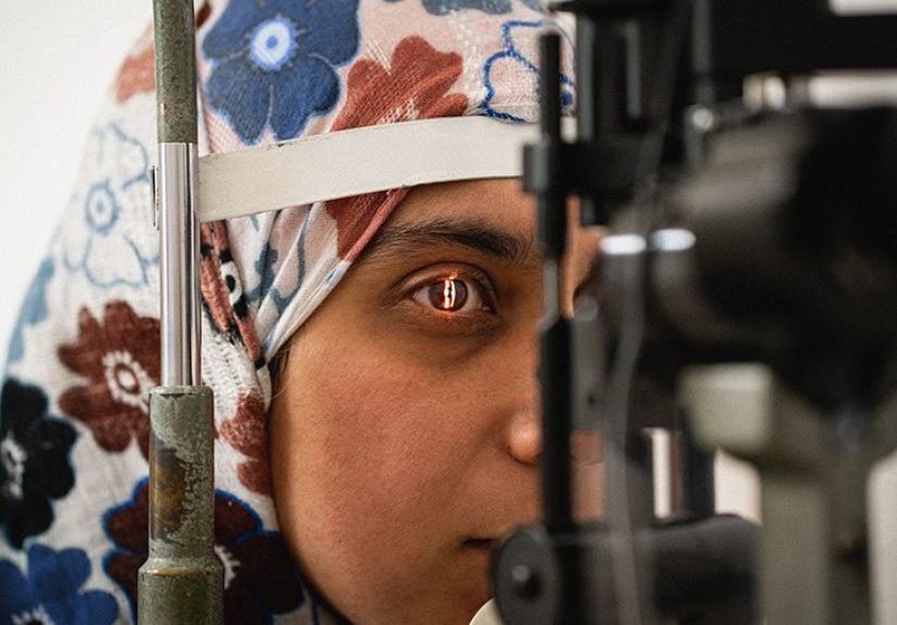 Ankylosing spondylitis: How it can affect the eyes