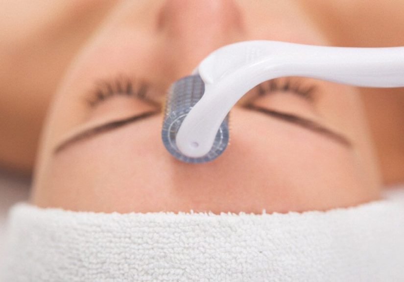 Microneedling with PRP: Benefits, Side Effects, Recovery & More