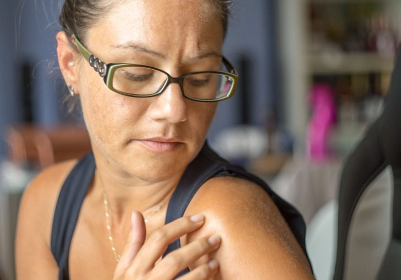 Painful Mole vs. Melanoma Signs: Skin Changes to Know