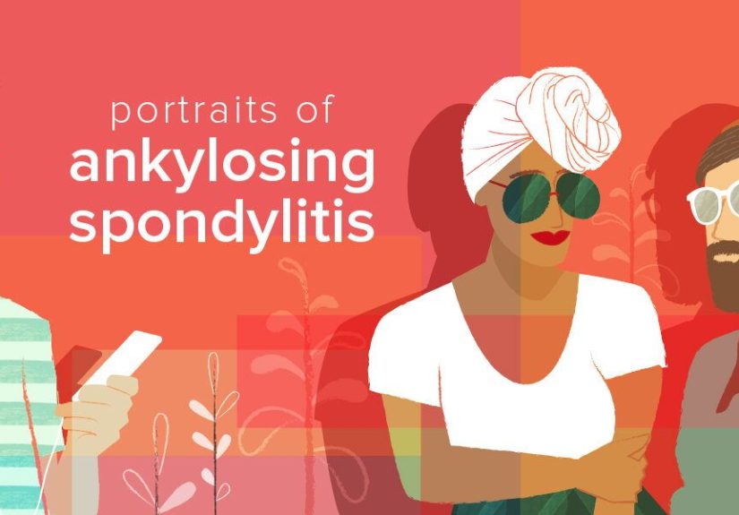 Portraits of Ankylosing Spondylitis
