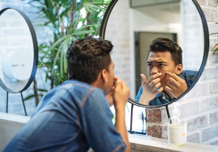 Difference Between Acne and Pimples