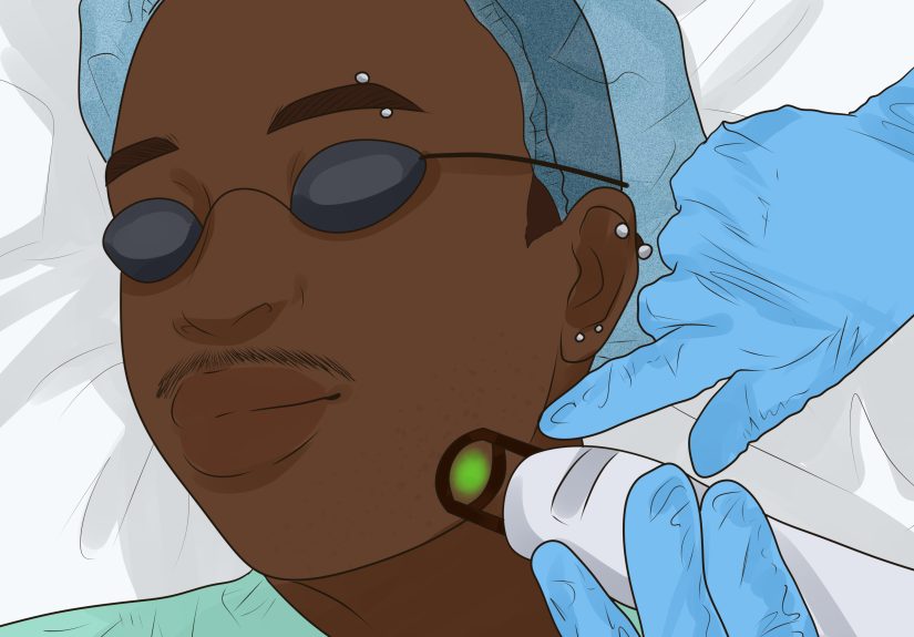 How to Remove an Ingrown Hair: 10+ Remedies & Prevention Tips
