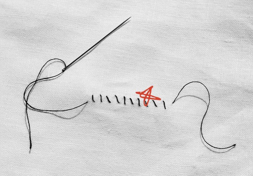 Infected stitches: Symptoms, treatments, and more
