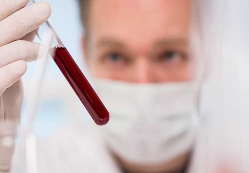 Lyme Disease Antibody Test: Purpose, Procedure, and Risks