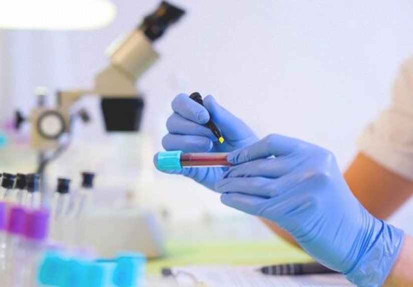 Neutrophils: Definition, Counts, and More