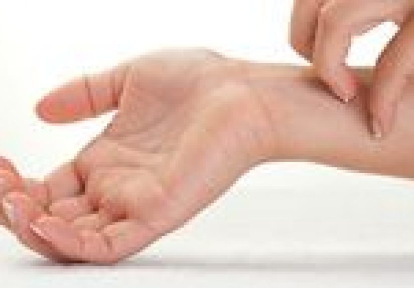 Picazón: Images, Causes, Diagnosis, Home Remedies, and More