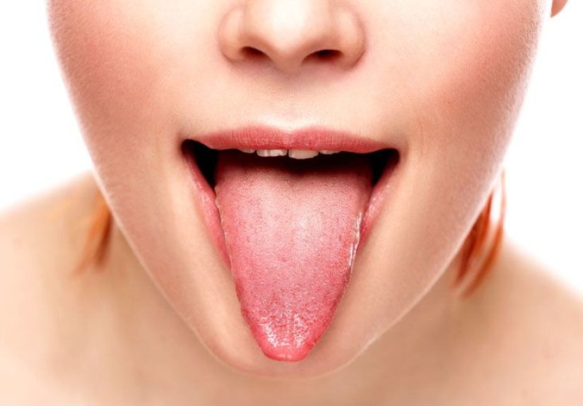 What is Glossitis? Types, Causes, and Symptoms