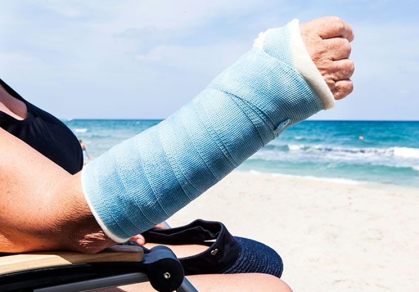 Wrist fracture: Risk factors, treatment, and recovery