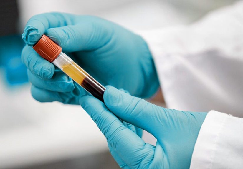 Blood Test for Gender: Accuracy and How Early You Can Find Out