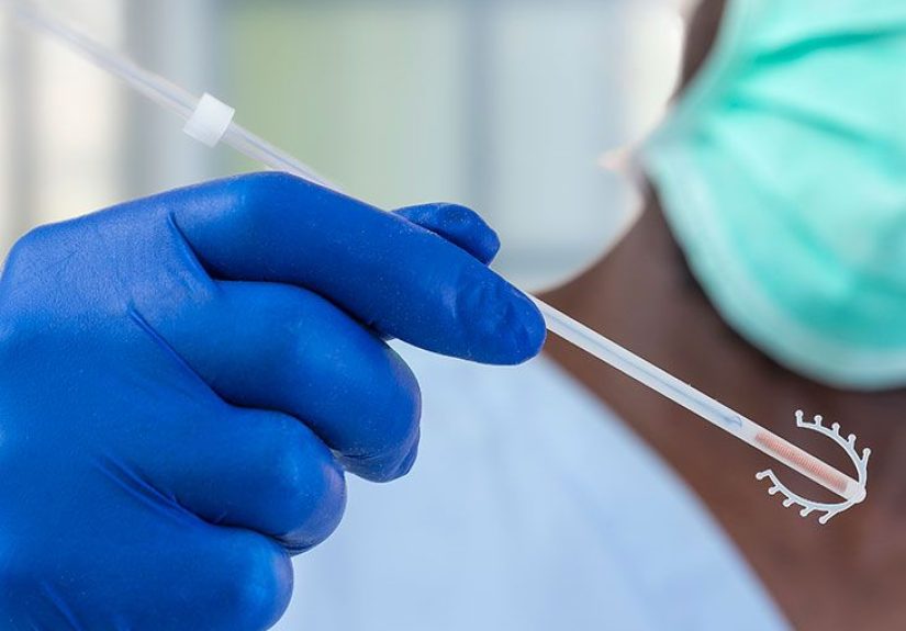 Copper IUD: Efficacy, Benefits, Side Effects, and Procedure