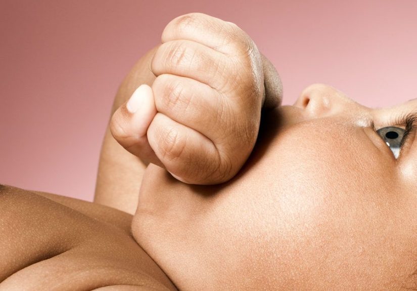 Cross-Eyed Baby (Strabismus): Causes and Treatment