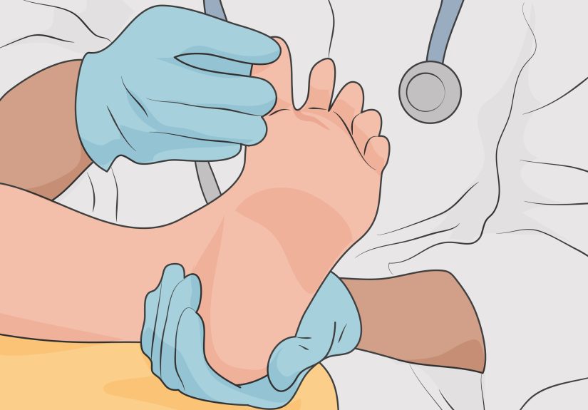 Effective Ways to Treat Painful Cuts and Cracks Between Your Toes