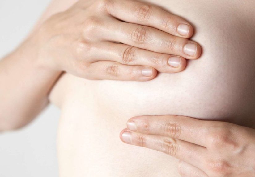 Hoyuelos del cáncer de mama: causas y tratamiento
