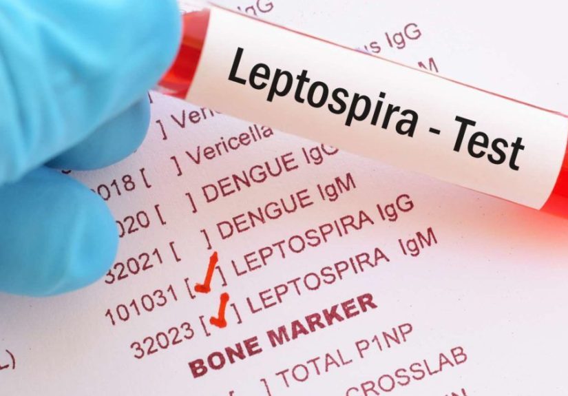 Leptospirosis: Treatment, Symptoms, and Types