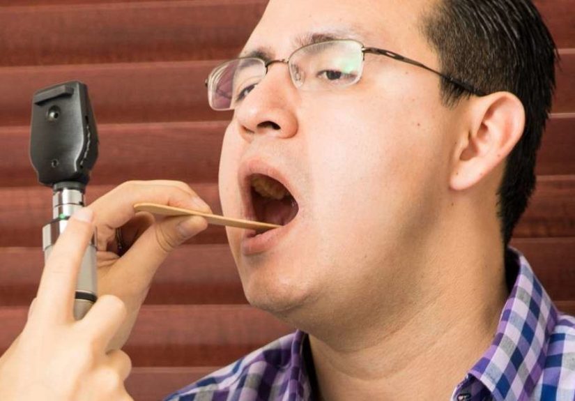 Peritonsillar Abscess: Causes, Symptoms, Diagnosis, and Treatment