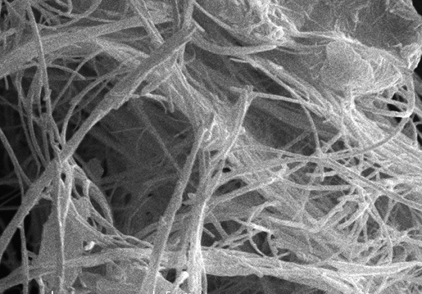 What Causes Asbestosis? Finding Asbestos and Living With Asbestosis
