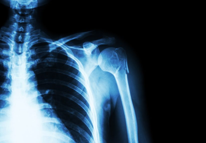 Why do we still use CD-ROMs for radiology images?