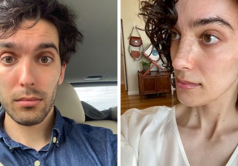 Woman Reveals Her Transition Photos After Taking Hormones For 14 Months